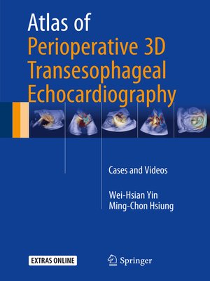 cover image of Atlas of Perioperative 3D Transesophageal Echocardiography